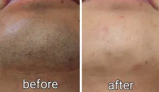 メンズ 姫路御立脱毛サロンSClass.所属・姫路御立脱毛サロン S Class.のエステ・リラクイメージ