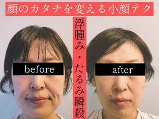 小顔美容鍼専門サロン 渋谷YZのエステ・リラクイメージ