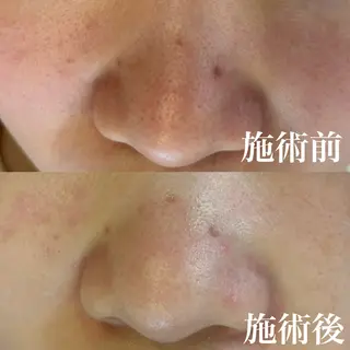 まつげ美人所属・毛穴 専門店のエステ・リラクイメージ