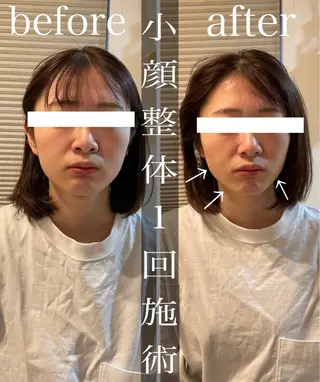 鍼灸整骨院Refine所属・鍼灸 Refineのその他イメージ