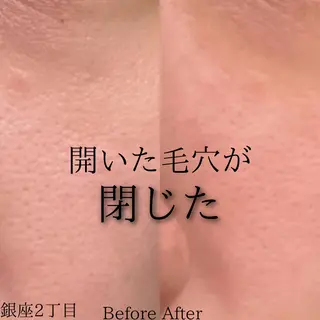 Ginza Charerのエステ・リラクイメージ