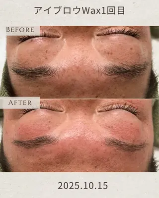 アイブロウ シミ毛穴|眉Wax THE flowのエステ・リラクイメージ