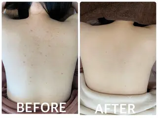 ハーブピーリング 横浜のエステ・リラクイメージ