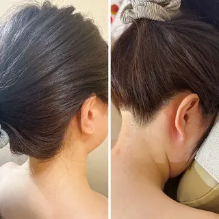 うなじ脱毛/美肌脱毛 LABELのエステ・リラクイメージ