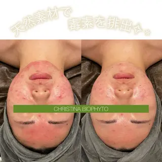 ☆痩身/小顔☆ 結果出します☆のエステ・リラクイメージ