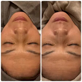 yellow.所属・yellow💛【 脱毛&フェイシャル】のエステ・リラクイメージ