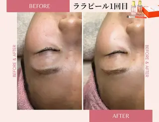 医療提携サロン&パーソナルカラー/骨格/顔タイプ診断 La chic所属・パーソナルカラー &エステ SHIHOのその他イメージ