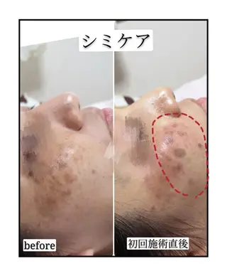 🅖🅤🅩🅔🅛 salonのエステ・リラクイメージ