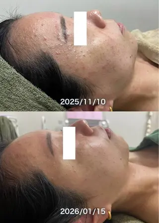 韓国美肌/肌質改善 【天神】のエステ・リラクイメージ