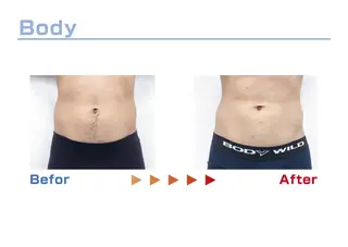 セルフ脱毛/美尻イス キングスサロン熊本のエステ・リラクイメージ