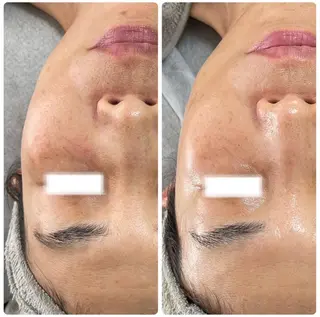 Esthe salon Blanche(エステサロンブランシュ)所属・小顔リフトアップ 美肌改善専門店のエステ・リラクイメージ