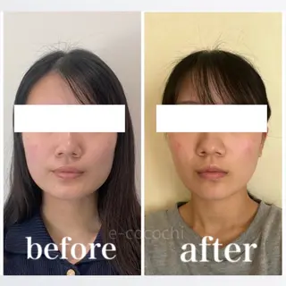 小顔と ヘッドスパのお店のエステ・リラクイメージ