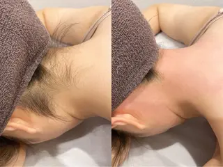 VIO脱毛専門店　kika〜キカ〜所属・【メンズSTART】 VIO専門店kikaのエステ・リラクイメージ