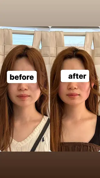 美容鍼灸サロンRemeリミー所属・美容鍼WINBACK サロンRemeのエステ・リラクイメージ