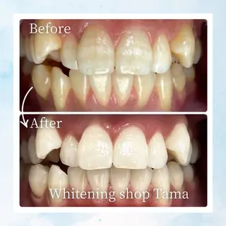 ホワイトニング ショップ多摩店のその他イメージ