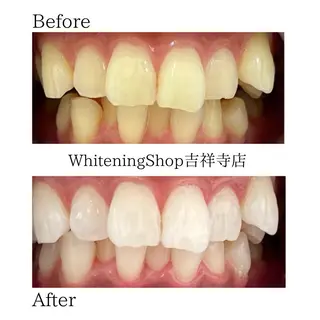 ホワイトニング ショップ吉祥寺店のエステ・リラクイメージ