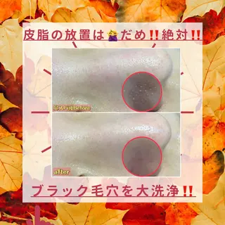 毛穴フェイシャル エステ専門店BBのエステ・リラクイメージ