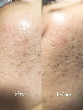 A.mstic 美肌、美ボディ専門店のエステ・リラクイメージ