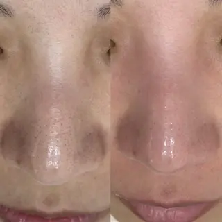 毛穴に特化したサロン MYFAIRLADYのエステ・リラクイメージ