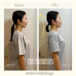 小顔美容矯正勝山式 shiroしろのエステ・リラクイメージ