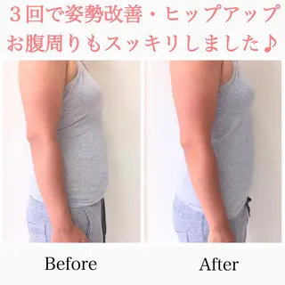 小顔モニター 募集のエステ・リラクイメージ