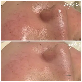 メンズ メナード岐阜茜部 杉浦のエステ・リラクイメージ