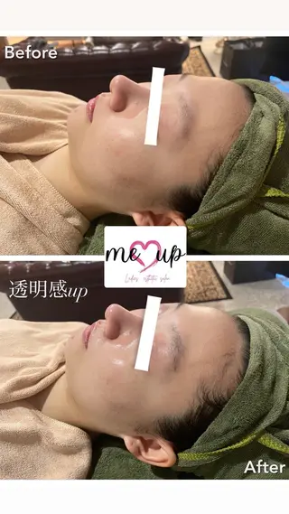 Meupニキビ専門店 背中/ハーブ/肌管理のその他イメージ