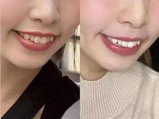 ホワイトニング専門店 LCS 汐留店 森田のその他イメージ