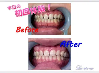 セルフホワイトニングサロン　ラヴィアン所属・ホワイトニングサロン La vie enのその他イメージ