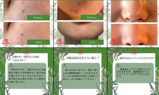 メンズ beauty salonnのエステ・リラクイメージ