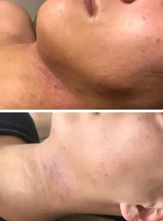 調律エステ /美KISSのその他イメージ