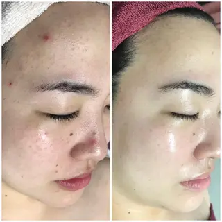 高速脱毛エステ リアンのエステ・リラクイメージ