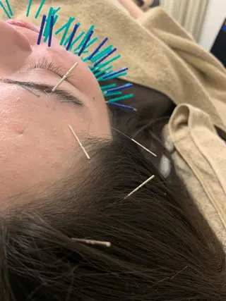 表参道鍼灸院K 美容鍼🔮ララピールのエステ・リラクイメージ