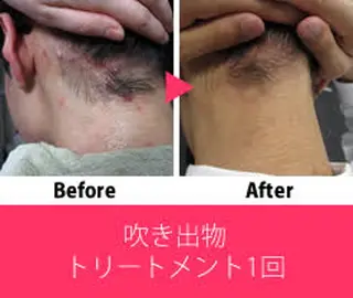 ビューティーラウンジ A&A✨佐藤✨のエステ・リラクイメージ