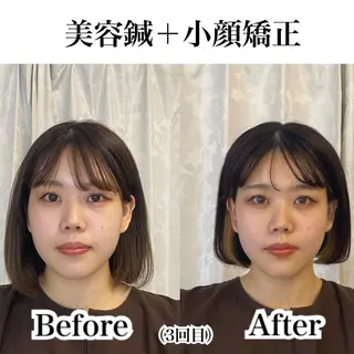 ✨ハリグリッター 太田理来✨のエステ・リラクイメージ