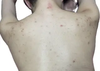 透明感の肌Lino malieのエステ・リラクイメージ