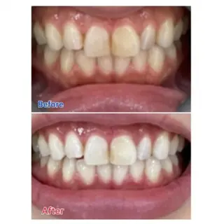 M渋谷店所属・Ｍ渋谷 ホワイトニングのエステ・リラクイメージ