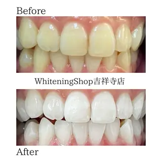 ホワイトニング ショップ吉祥寺店のエステ・リラクイメージ