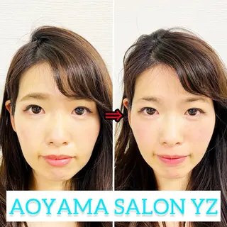 小顔美容鍼専門サロン 渋谷YZのエステ・リラクイメージ