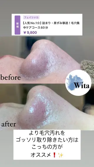 Wita   aesthetic×eyelash所属・上坂 祐以のエステ・リラクイメージ