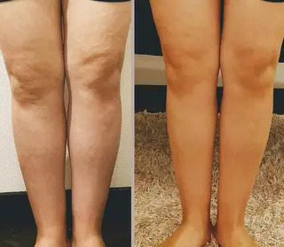 🅖🅤🅩🅔🅛 salonのエステ・リラクイメージ