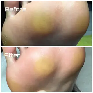 メンズ ネイル ドクターネイル爪革命 takahashiのその他イメージ