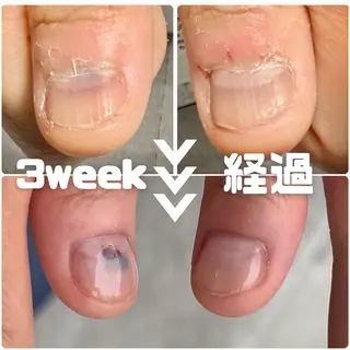 ネイル Private Nail Salon OK所属・FUKA ♡のネイルデザイン