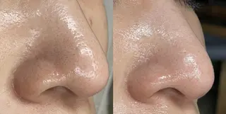 sii センター北 AIのエステ・リラクイメージ