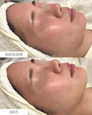 美の宝石屋さん gemme【ジェム】所属・gemme -ジェム-のエステ・リラクイメージ