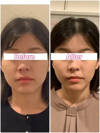 美容鍼・整体サロン アネモネ🌸心斎橋のエステ・リラクイメージ