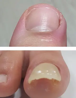 ネイル 北浦和 自爪育成ケアのネイルデザイン