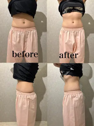 腸活サポート みなみののエステ・リラクイメージ