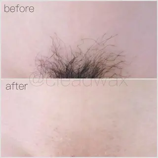 CLEAD 赤坂見附店のエステ・リラクイメージ