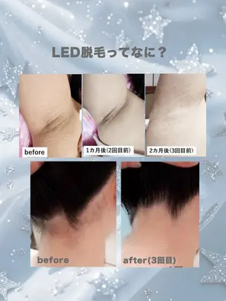 Kanunu所属・鶴橋エステ kanunuのエステ・リラクイメージ